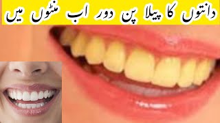 How to whiten Teeth at Home | yellow Teeth || Natural Way to whiten  your Teeth ( Home Remedy )