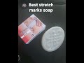 remove stretch marks only in two weeks