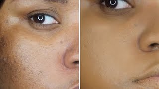 How to Cover Large Pores in Seconds!!!|Monamillions TV