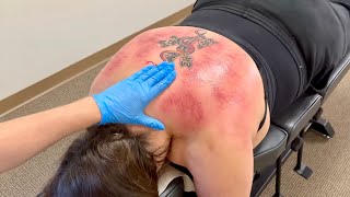 WHEN BACK PAIN NEEDS TO BE RESOLVED