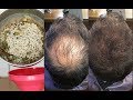 YOUR HAIR WILL GROW LIKE CRAZY- GROW HAIR Long, Thick & Healthy FAST!