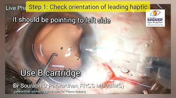 How to insert 3 piece IOL in the bag Dr Sourabh Patwardhan