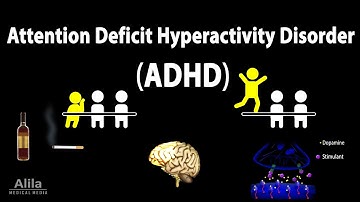 Attention Deficit Hyperactivity Disorder (ADHD), Animation
