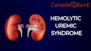 Hemolytic Uremic Syndrome