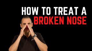 How to treat a broken nose: tips and tricks from a facial plastic surgeon