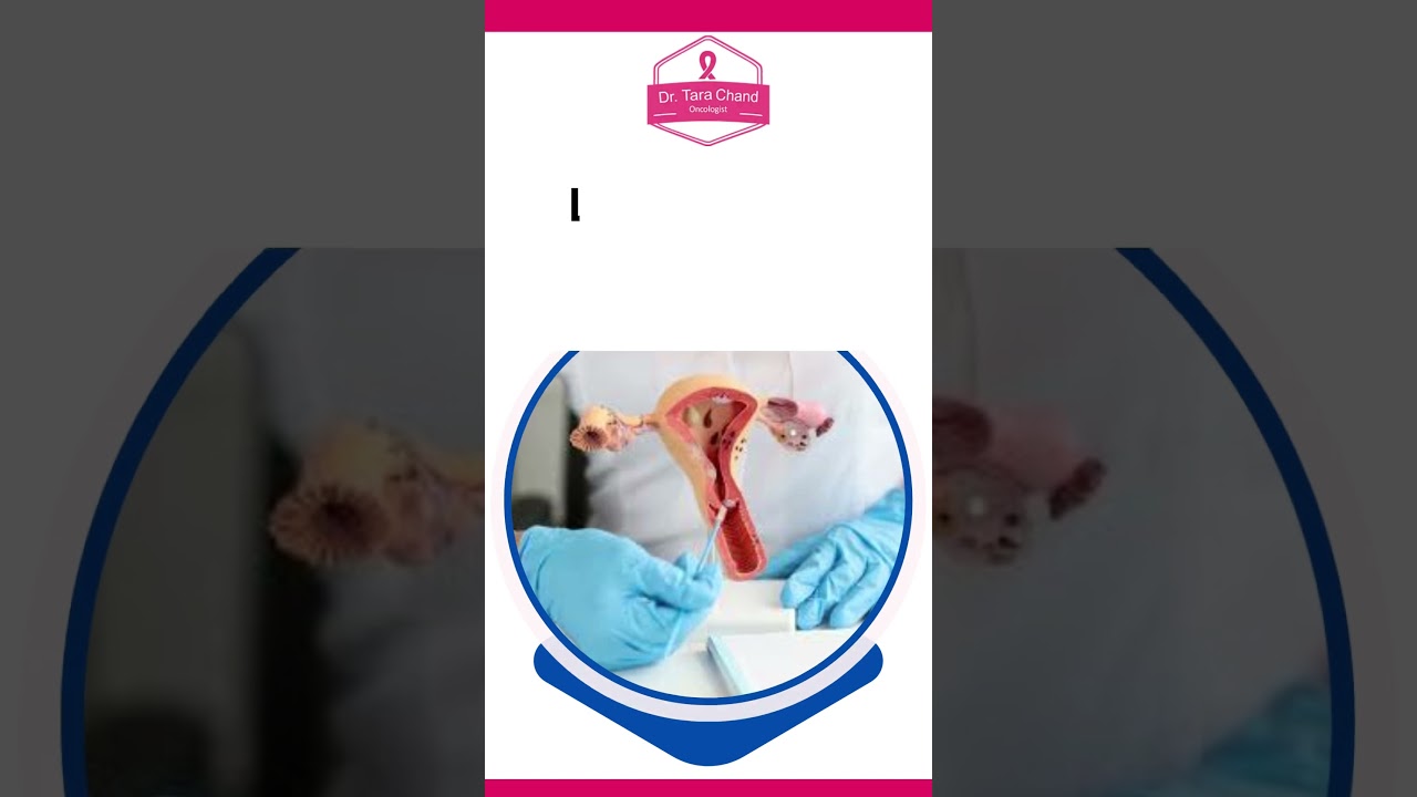 Top 5 most common cancer in India