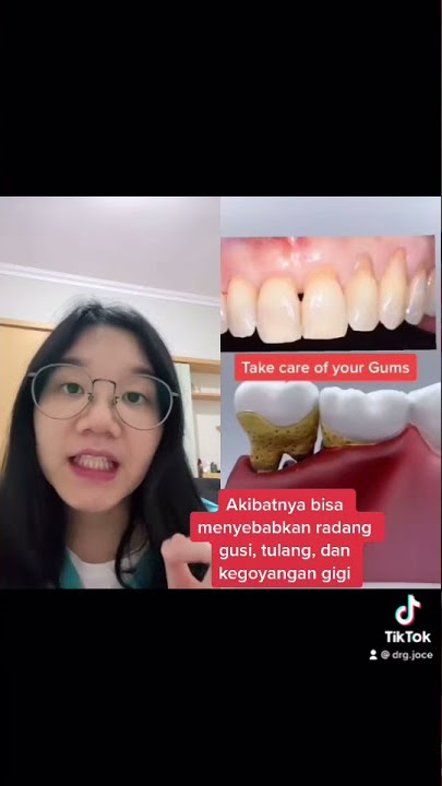 SIKAT GIGI KERAS-KERAS bisa bikin GUSI TURUN?