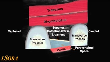 Paravertebral US block