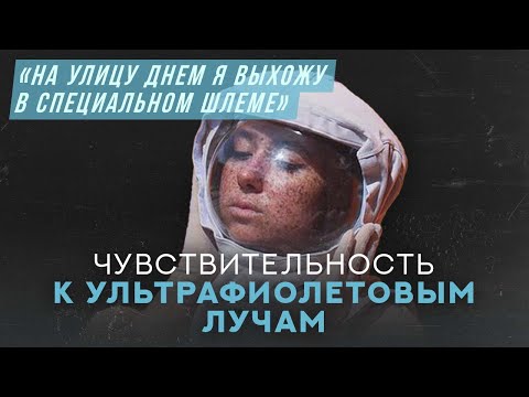 Видео: Меня убивает солнце | Хочу спросить