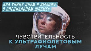 Меня убивает солнце | Хочу спросить