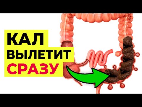 Как избавиться от запора БЕЗ ЛЕКАРСТВ! / Эффективный способ избавления от запора РАЗ И НАВСЕГДА!