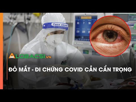 Video: Đau mắt do coronavirus