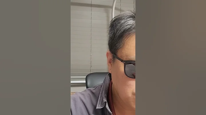 오르비텍/ 셀트리온 주가전망- 턴어라운드 성공// 시사이슈- 윤석렬은 사익추구형 음모론자