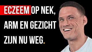 Eczeem en huidklachten geheeld zonder medicatie