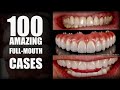 100 Cases for Lucky Dental Patients