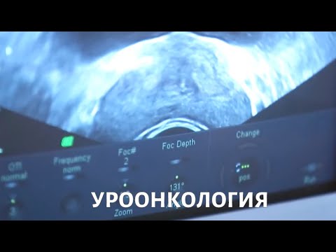 Уроонкология. Медицина будущего