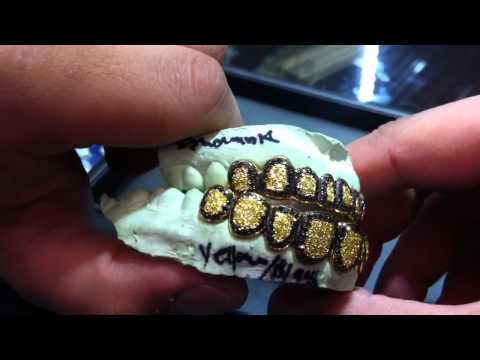 Download] Black And Yellow Diamond Grill