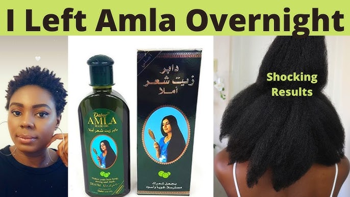 Dabur Amla Hair Oil - Amla Oil, Amla Hair Oil, Amla Oil for Healthy Hair  and Moisturized Scalp, Indian Hair Oil for Men and Women, Bio Oil for Hair