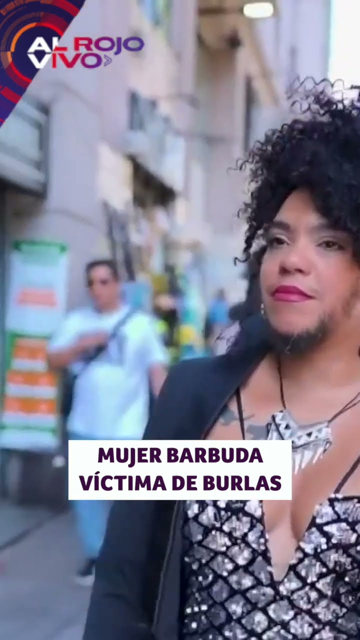 'La Mujer Barbuda' demuestra su fortaleza tras sufrir burlas | ARV