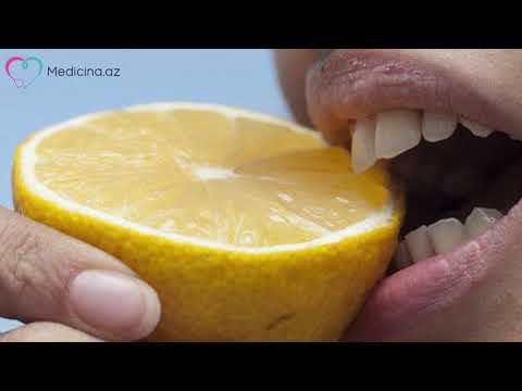Bu şəxslərə limon