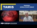 TAMIS PROF.DR.UĞUR DEVECİ