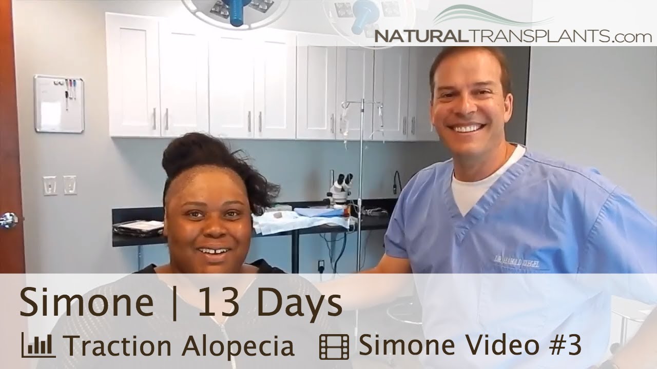 fue hair transplant month by month How To Grow Your Edges | Grow Edges Back (Simone)