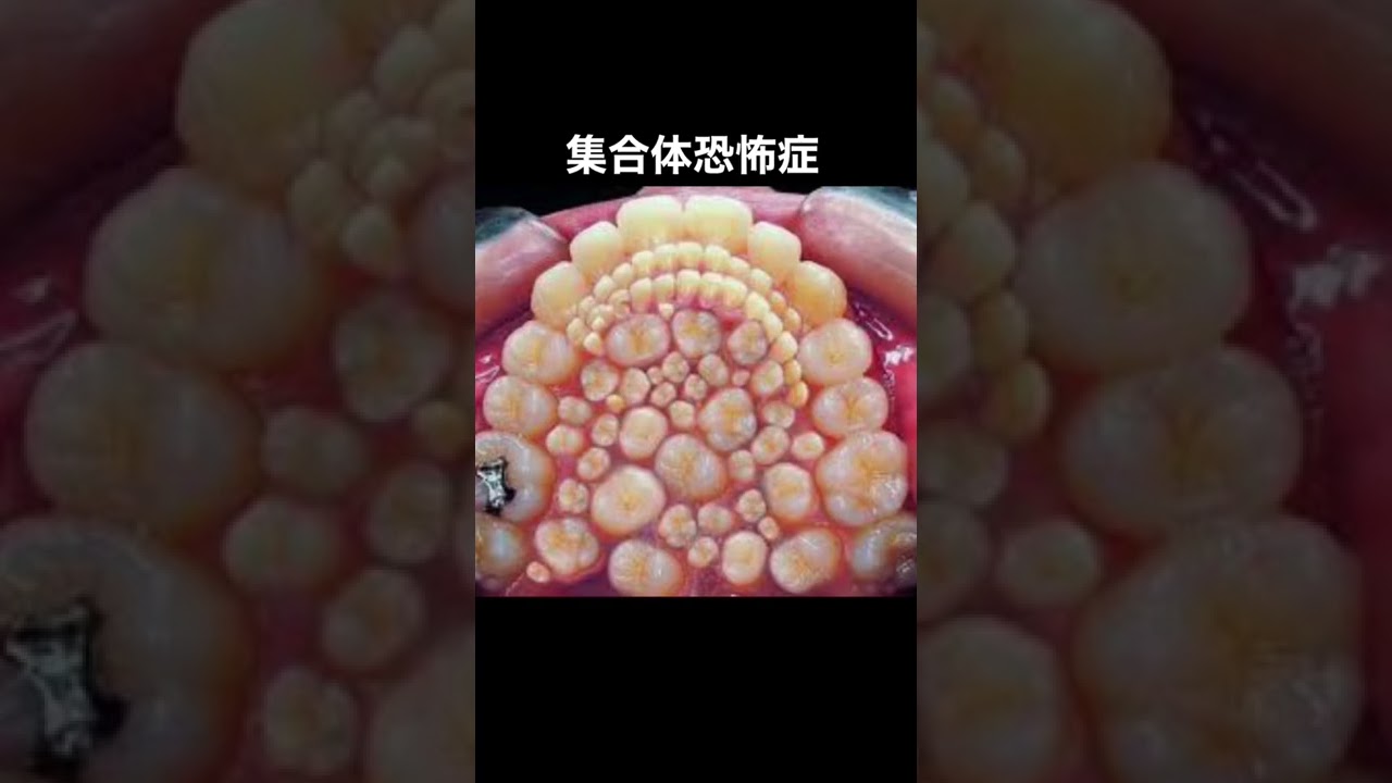 集合体恐怖症 Youtube