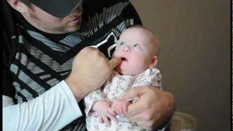 Oral Exercises for Babies with Down Syndrome