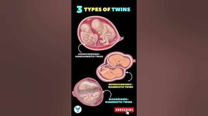 3 Types of Twins 🚼 🚼 Twin Pregnancy | Different types of Twins #shortsfeed #pregnancy #baby #twin