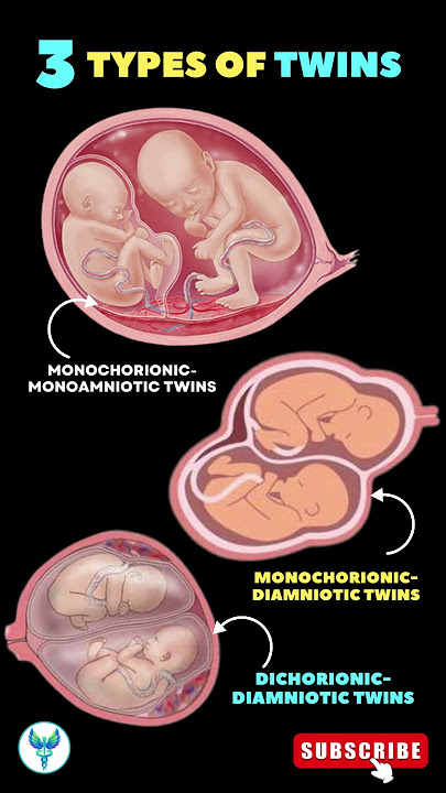 3 Types of Twins 🚼 🚼 Twin Pregnancy | Different types of Twins #shortsfeed #pregnancy #baby #twin