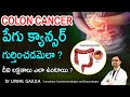 Colon Cancer Symptoms and Treatment | పెద్దప్రేగు క్యాన్సర్ లక్షణాలు | Colon Cancer| Dr Ujwal Gajula
