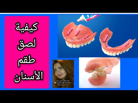 كيفية لصق طقم الأسنان بالصمغ و الغراء الطبي  لتثبيته في الفك د/إيريني