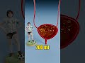 Human Bladder vs Whale Bladder