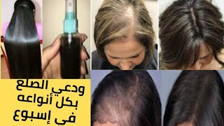 التركيبة الأقوى لإنبات الشعر وتكثيف فراغات الشعر/ علاج الصلع الوراثي Hereditary baldness treatment