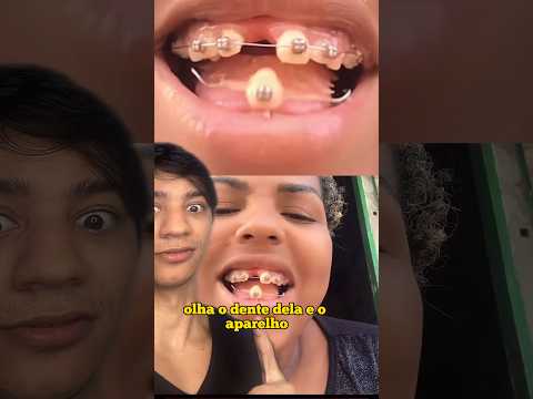 Vídeo: Como retirar um dente de um painel de quarto