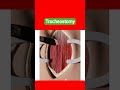 Tracheostomy #biology #youtubeshorts #shorts#shortsfeed