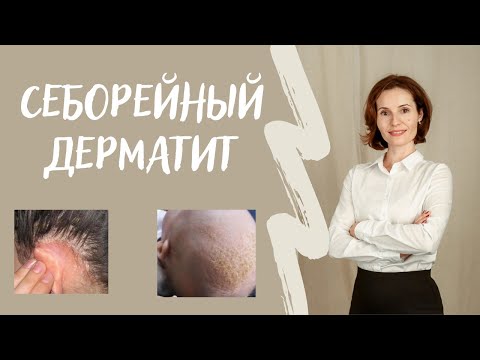 Бейне: Гнейсте жапырақтың қандай түрі болады?