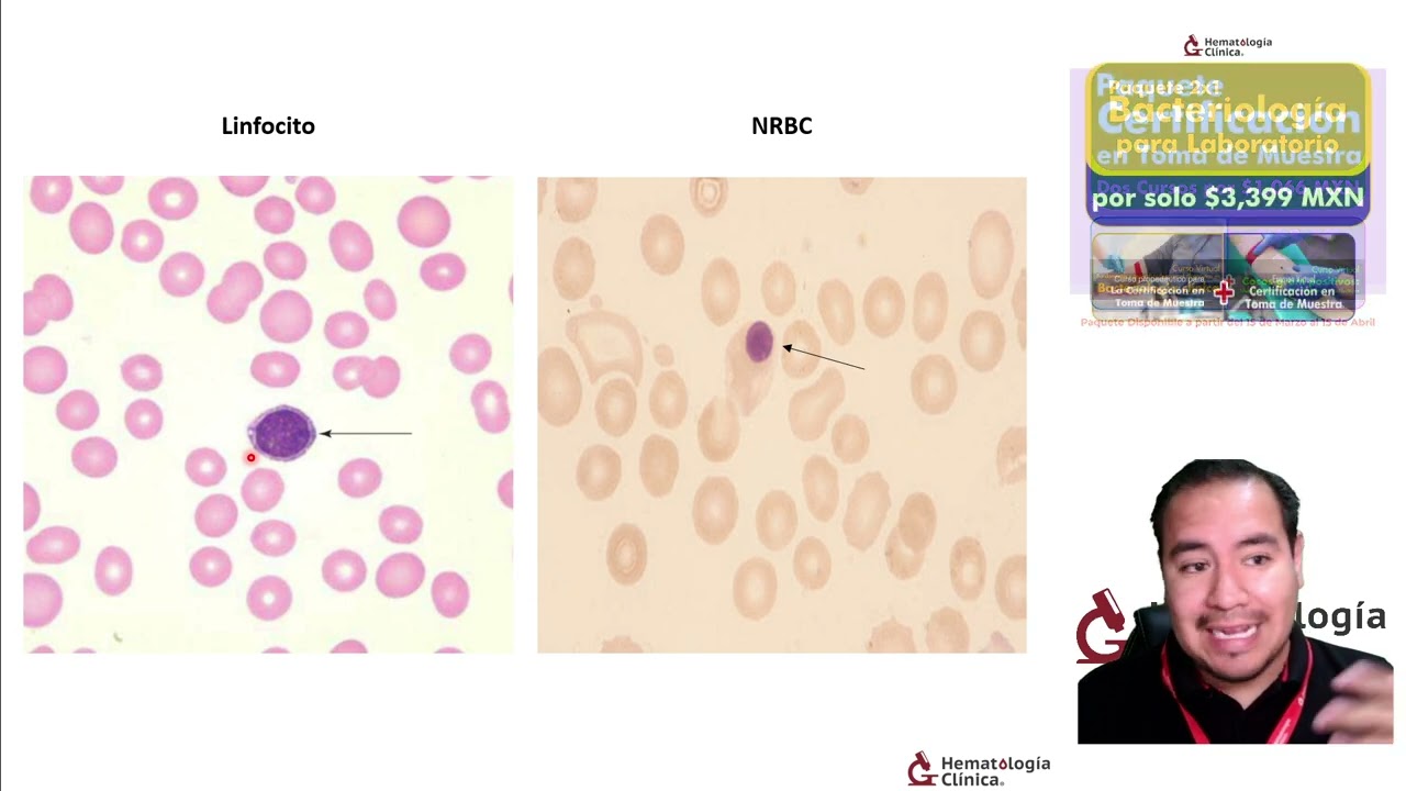 Diagnóstico sin errores. Todo sobre la corrección de Leucocitos por Eritroblastos