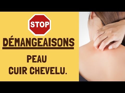 Vidéo: Huiles Essentielles Pour Les Pellicules - Contrôlez Les Démangeaisons Et La Desquamation