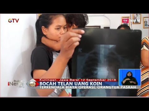 Video: Mengapa uang receh itu berbahaya?