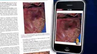 Rubin's Pathology Mobile Flash Cards screenshot 1