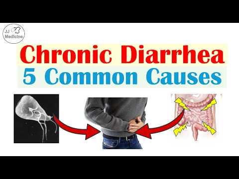 5 Common Causes of Chronic Diarrhea (Many People Don't Know About #4)