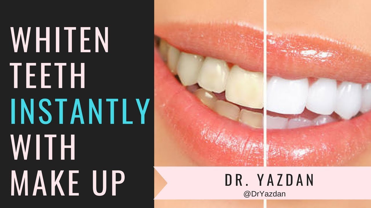 how to Whiten Teeth Instatly With Make Up 