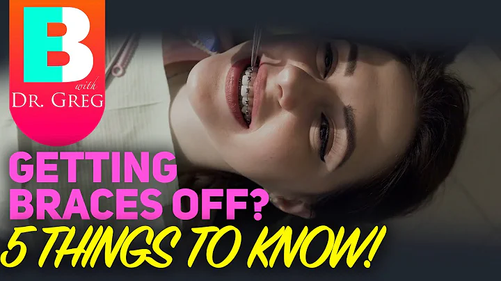 Få av dig tandställningen? 5 tips du bör veta!