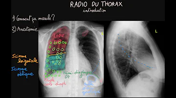 Pourquoi faire une radio du thorax ?