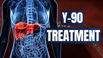 Understanding Y90 Radioembolization