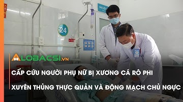 Cấp cứu người phụ nữ bị xương cá rô phi xuyên thủng thực quản và động mạch chủ ngực