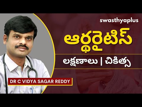 ఆర్థరైటిస్ - ఉన్న చికిత్స ఏమిటి? | Arthritis in Telugu | Signs & Treatment | Dr C Vidya Sagar Reddy