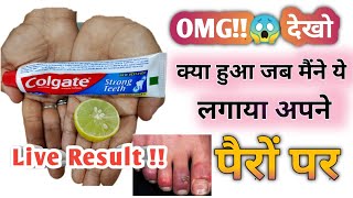 हैरान कर देने वाला Result  सामने आया जब मैंने ये लगाया | Colgate And Lemon Experiment | Jaya Malik