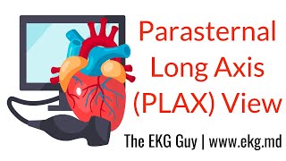 Parasternal Long Axis View - ECHO Course l The EKG Guy - www.ekg.md